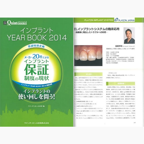 別冊ザ・クインテッセンス インプラント YEAR BOOK 2014 ELインプラントシステムの臨床応用 －前歯部に発生したトラブルへの対応－