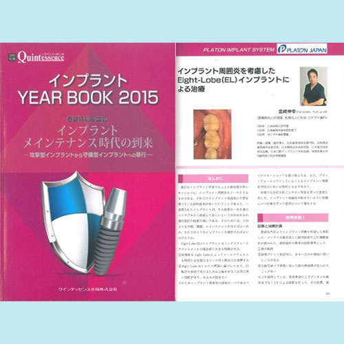 別冊ザ・クインテッセンス インプラント YEAR BOOK 2015 インプラント周囲炎を考慮したEight-Lobe（EL）インプラントによる治療