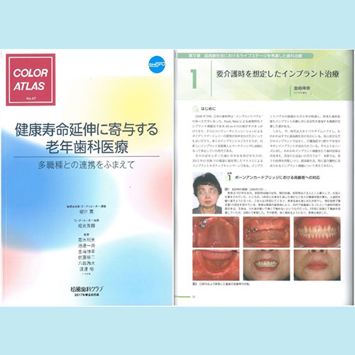 松風歯科クラブ COLOR ATLAS No.47 要介護時を想定したインプラント治療