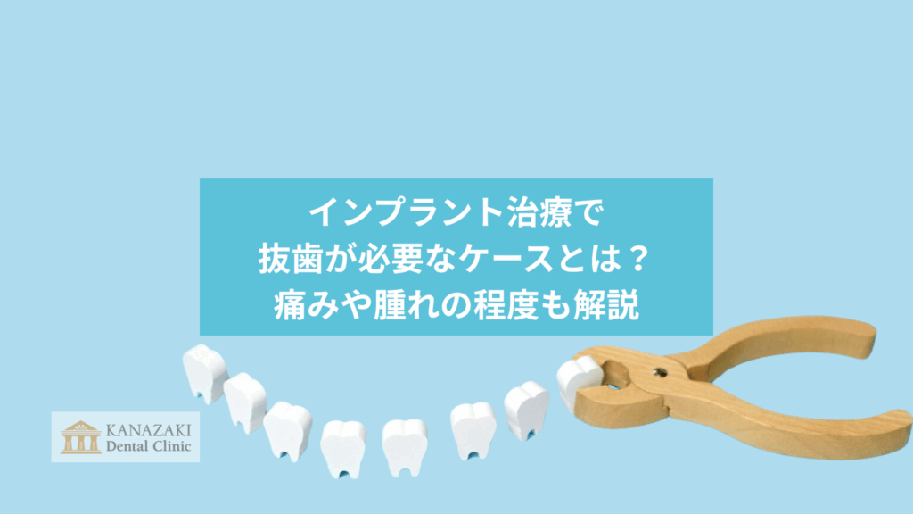 インプラント治療で抜歯が必要なケースとは？痛みや腫れの程度も解説のアイキャッチ