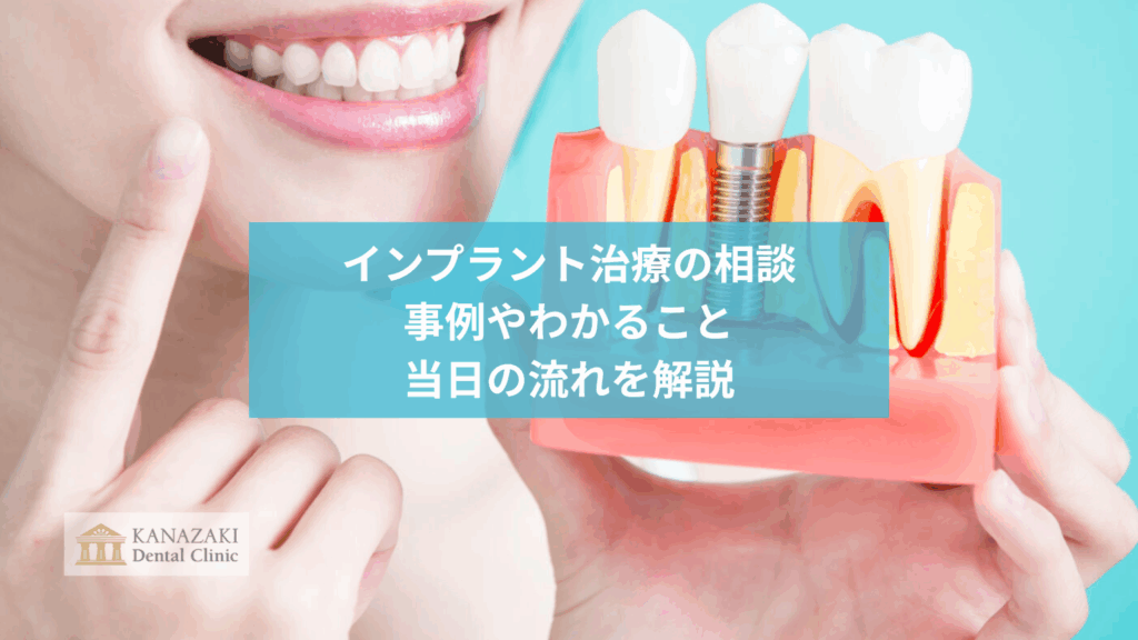 インプラント治療の相談｜事例やわかること、当日の流れを解説のアイキャッチ