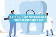 インプラント以外の治療方法3選！代表的な選択肢の特徴を比較のアイキャッチ