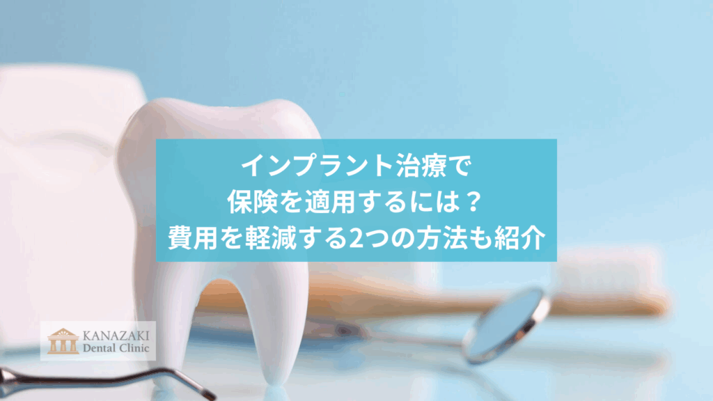 インプラント治療で保険を適用するには？費用を軽減する2つの方法も紹介のアイキャッチ