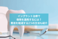 インプラント治療で保険を適用するには？費用を軽減する2つの方法も紹介のアイキャッチ
