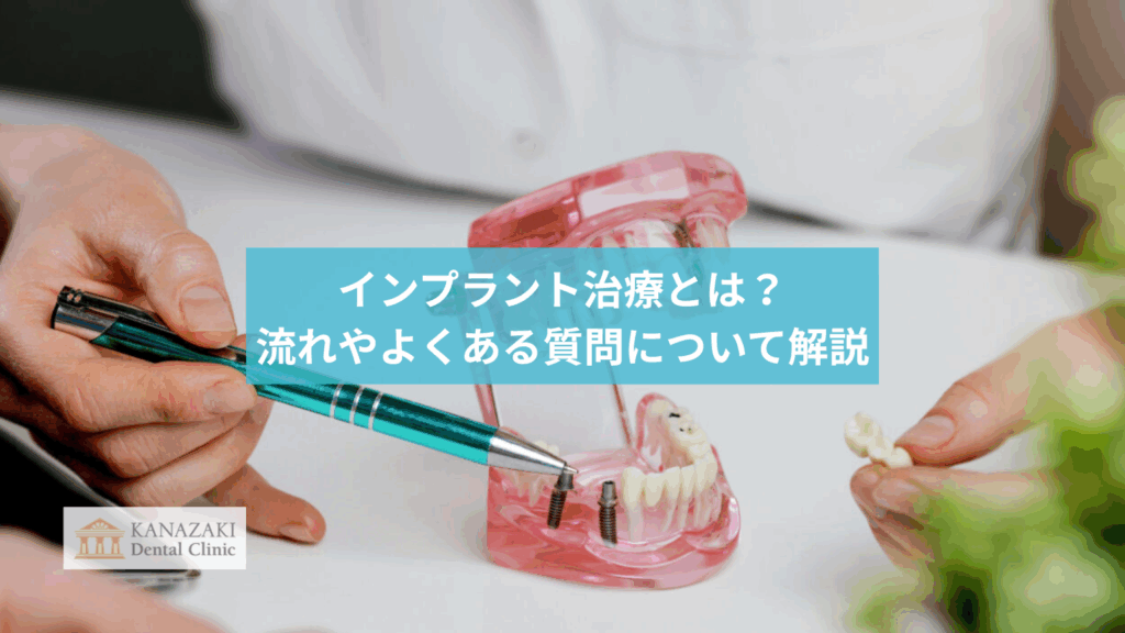 インプラント治療とは？流れやよくある質問について解説のアイキャッチ