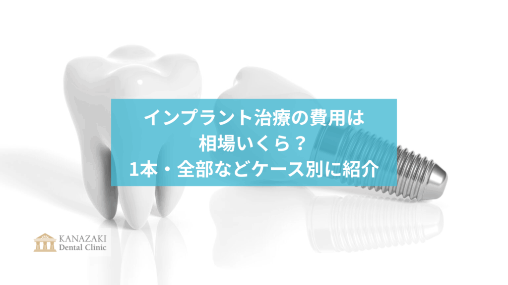 インプラント治療の費用は相場いくら？1本・全部などケース別に紹介のアイキャッチ