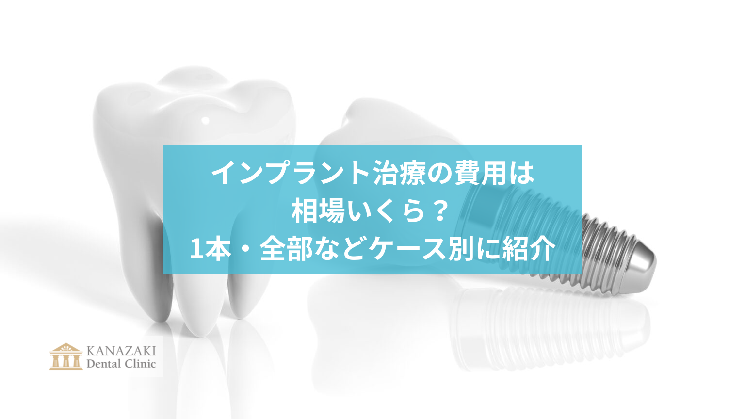インプラント治療の費用は相場いくら？1本・全部などケース別に紹介のアイキャッチ