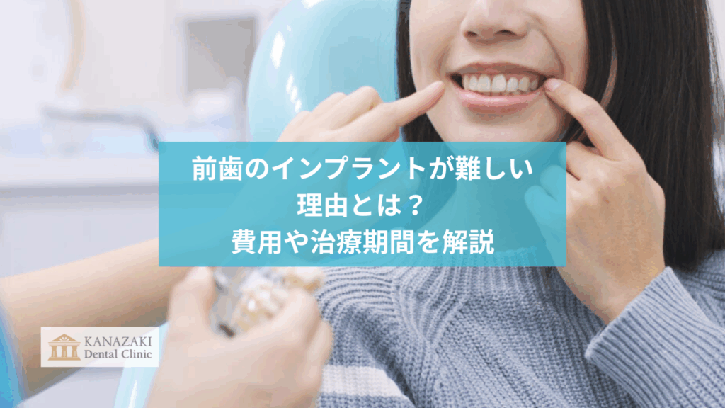 前歯のインプラントが難しい理由とは？費用や治療期間を解説のアイキャッチ