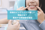 前歯のインプラントが難しい理由とは？費用や治療期間を解説のアイキャッチ