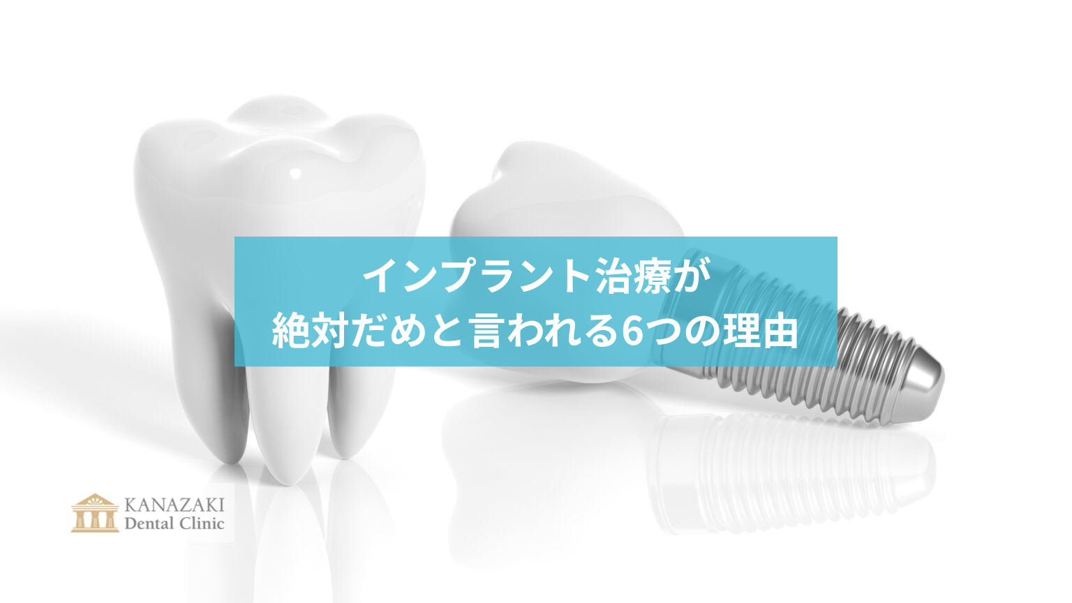 インプラント治療が 絶対だめと言われる6つの理由のアイキャッチ