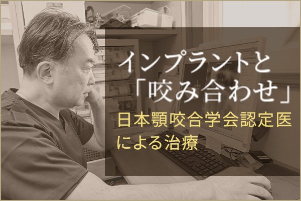  インプラントと「咬み合わせ」