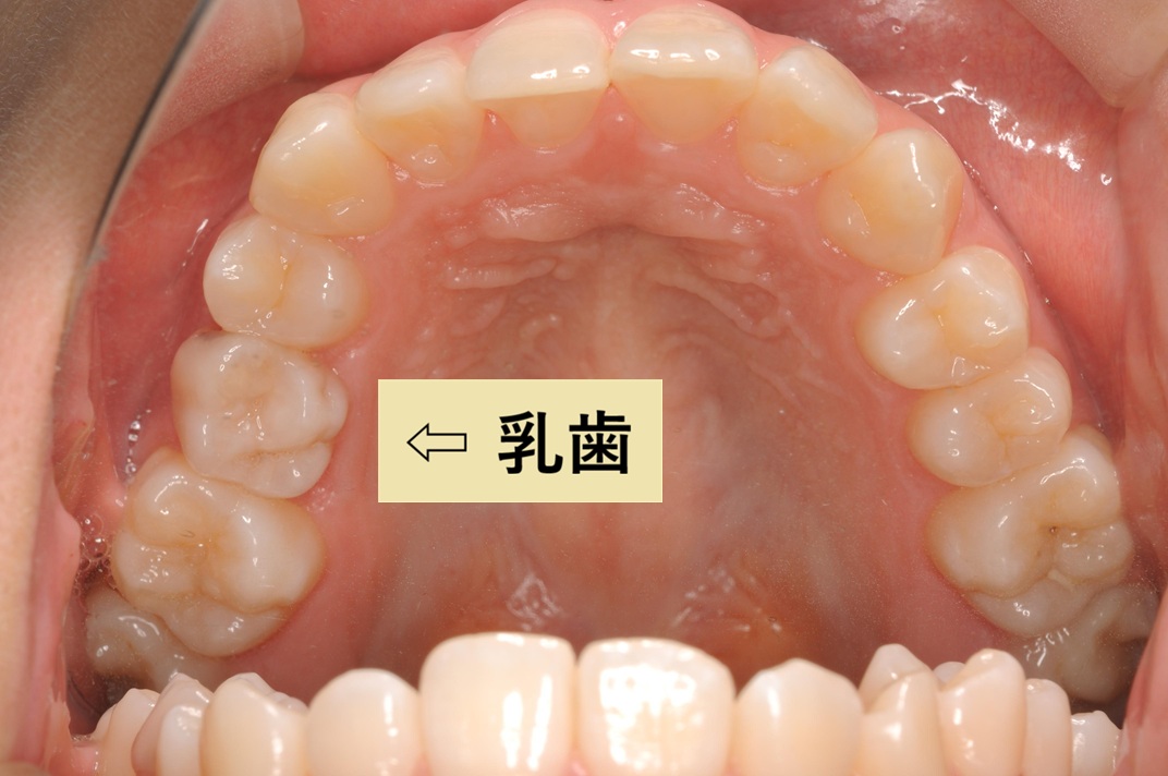 治療前